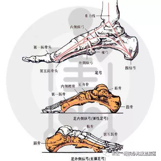 指任何骨,韧带,肌肉生理异常,导致足内侧,外侧纵弓和横弓出现塌陷